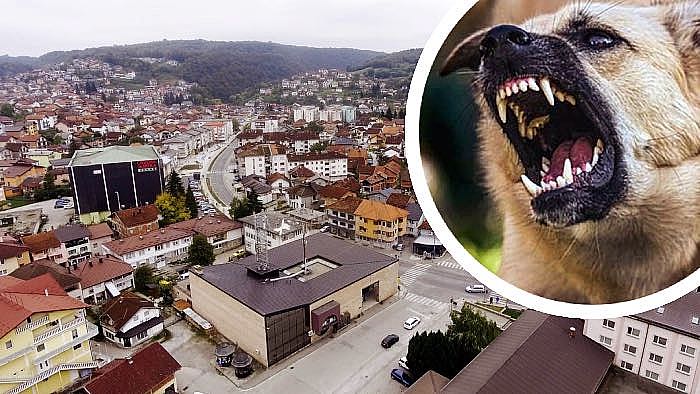 Pas napao 64-godišnju ženu, završila na Hitnoj