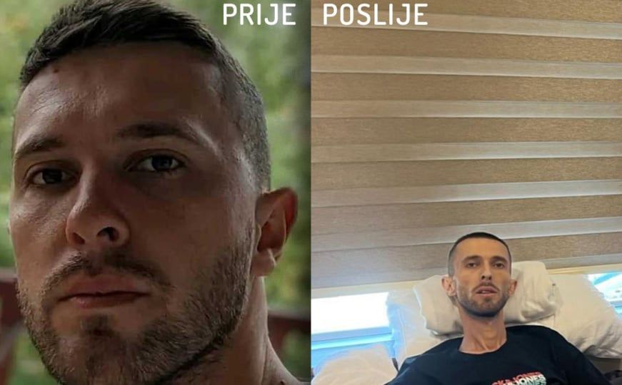 Spasimo život Hikmetu Adiloviću (33), bori se s rakom želuca. Pozovite 17007