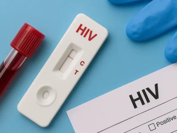 Svijet bi mogao izgubiti decenije napretka u borbi protiv HIV-a
